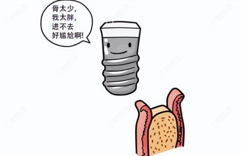 做牙槽骨手术费用大概是多少