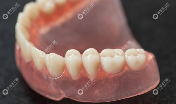 活动假牙的种类及价格详细介绍.附活动假牙选那种材料好
