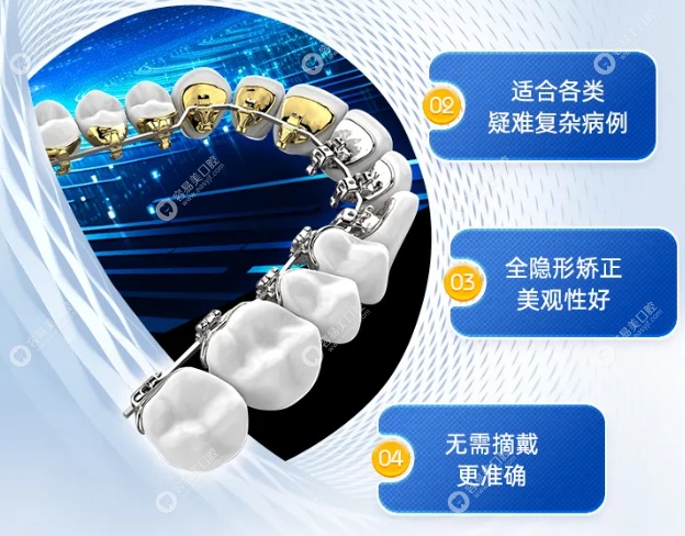 成都极光口腔舌侧正畸活动