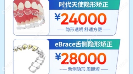 广州穗华口腔牙齿矫正技术优势