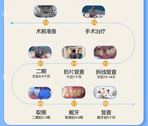 毛智勇种牙技术怎么样