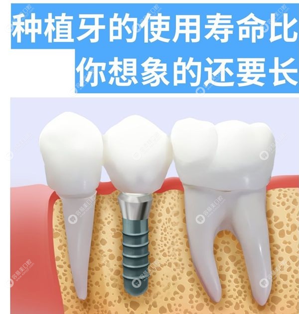 深圳河马看牙口腔立华门诊部核心项目
