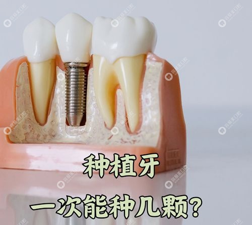 毛智勇擅长种什么牙