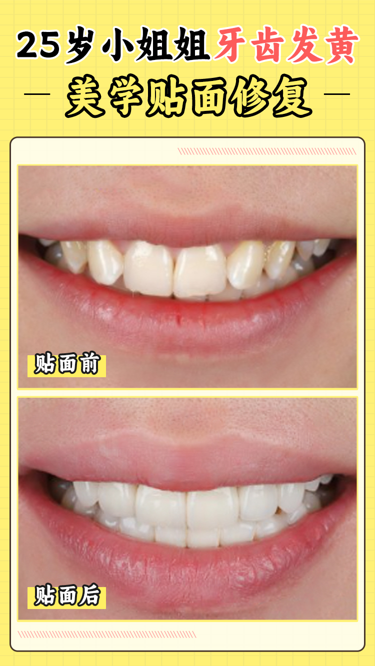 2026新攻略！贺州牙博士口腔怎么预约？3种挂号方式+2大院区地址一键收藏