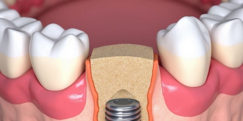 昆明竹子口腔医院特色项目及价格