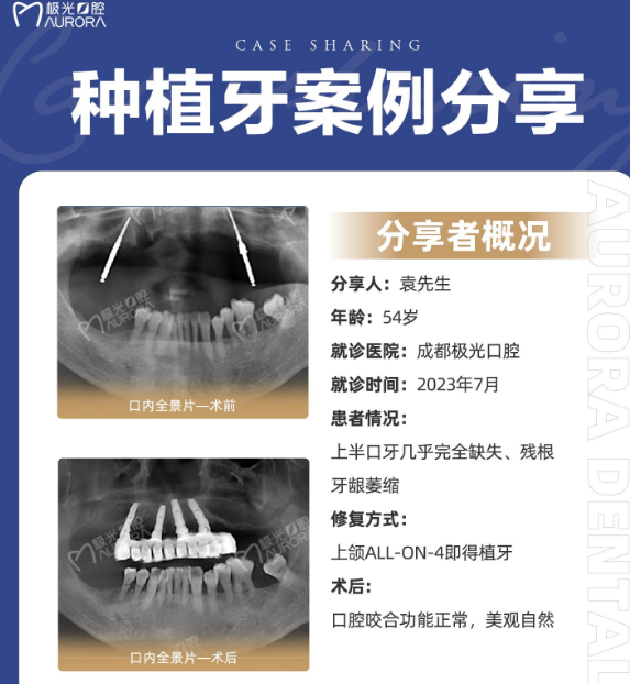 极光口腔种植牙病历