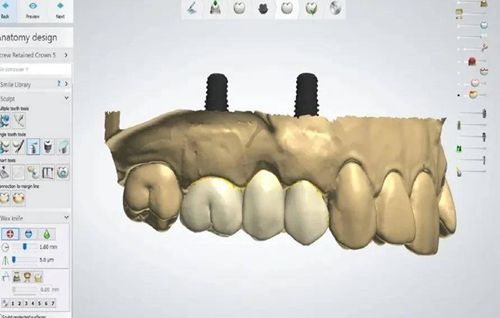 廣州博仁口腔門診部收費價格