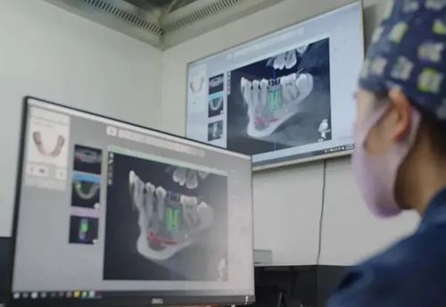 廣州德倫粵墾口腔門診部擅長哪些項目