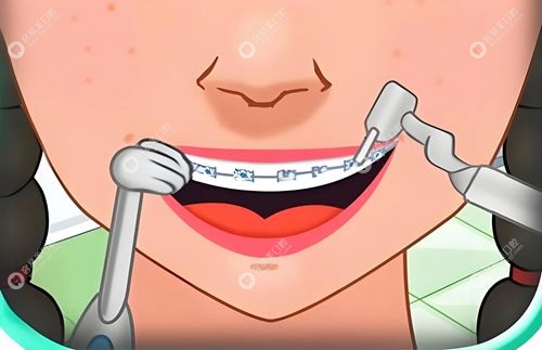 黄丽珠医生擅长项目 黄丽珠医生擅长项目