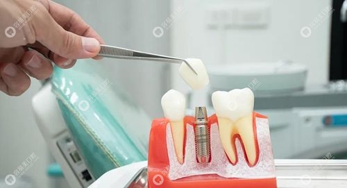 王桥医生擅长项目 王桥医生擅长项目