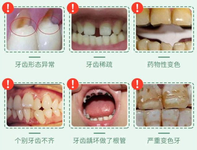淮安诺贝尔口腔价目表