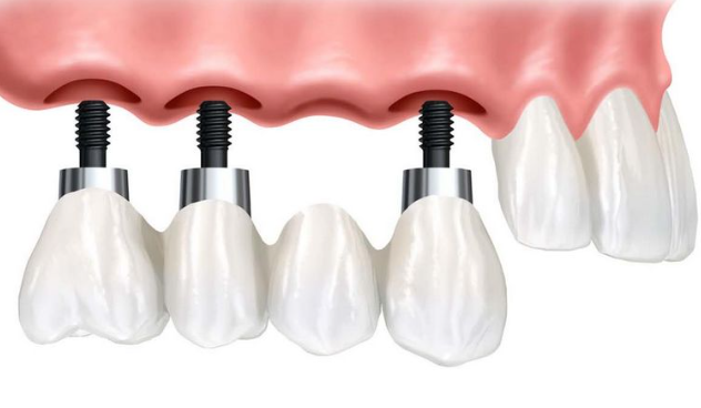 泉州乐莎莎口腔口碑怎么样