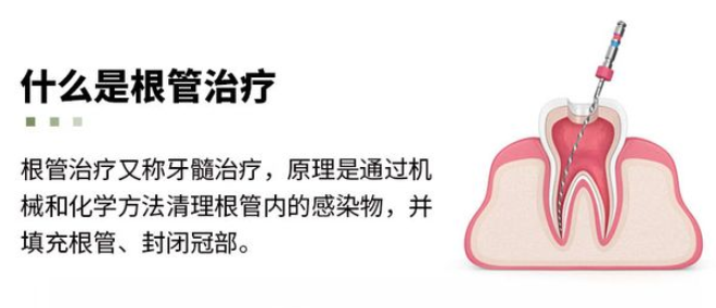 深圳根管治疗哪里做便宜又好？附10家明码标价牙科，最低500元全包