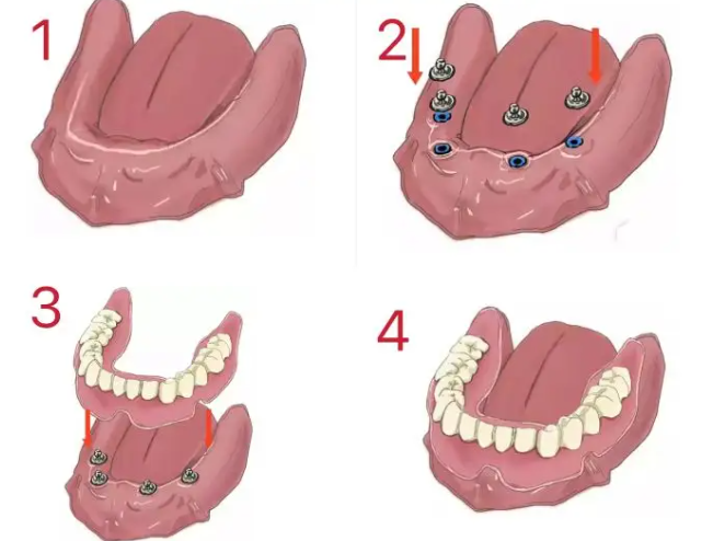 南通美特美口腔联系方式全公开：挂号指南含电话/微信/现场预约