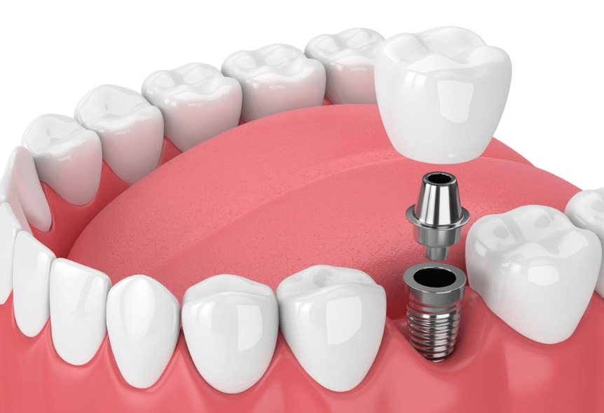 深圳新佳和口腔门诊部