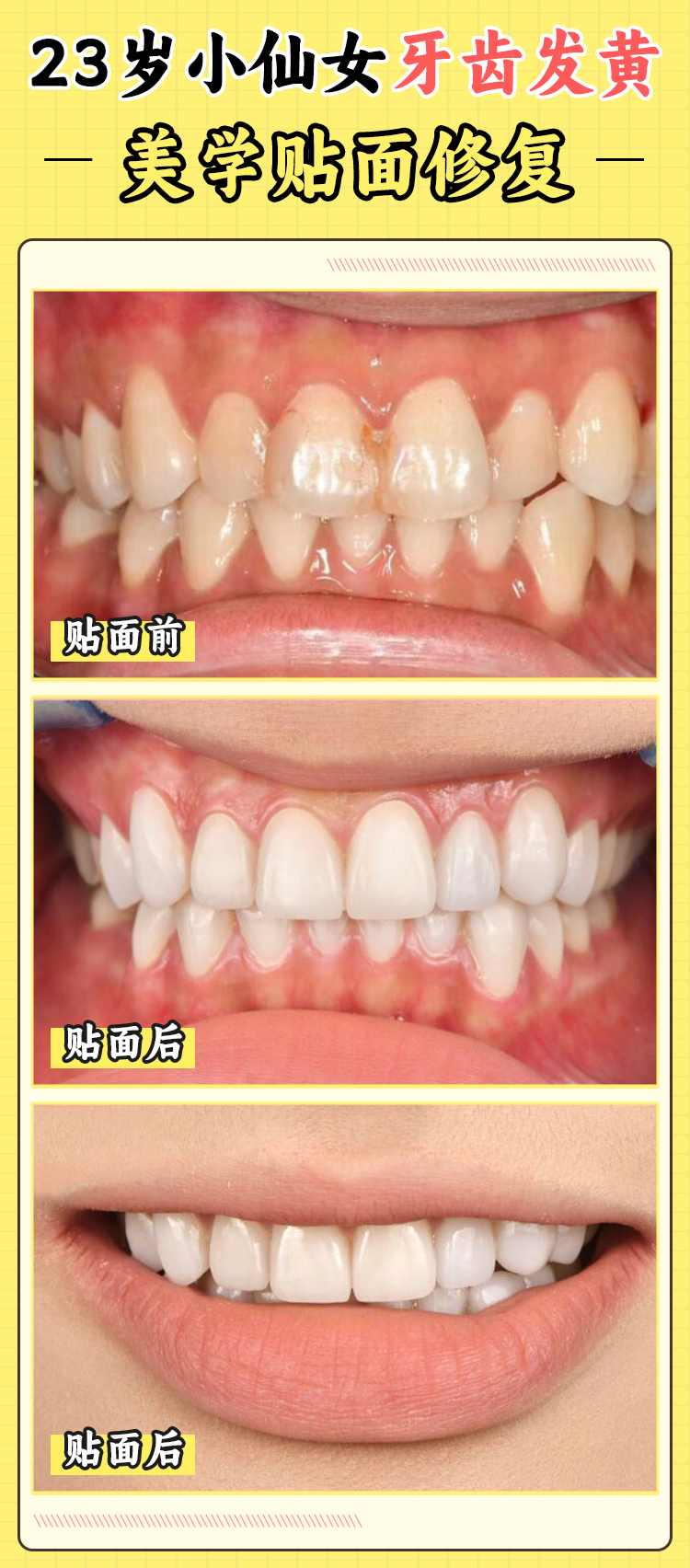 杭州杭里口腔的价格体系与性价比分析