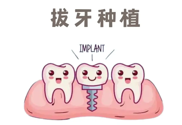 深圳美思特口腔种植牙价格全公开：中年人种牙8918元起含术后维护费