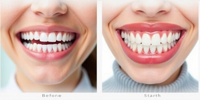 汕头哪里牙科便宜又好？2025汕头10家私立牙科榜单！奥诗卡/天佑/健芽种牙补牙都划算