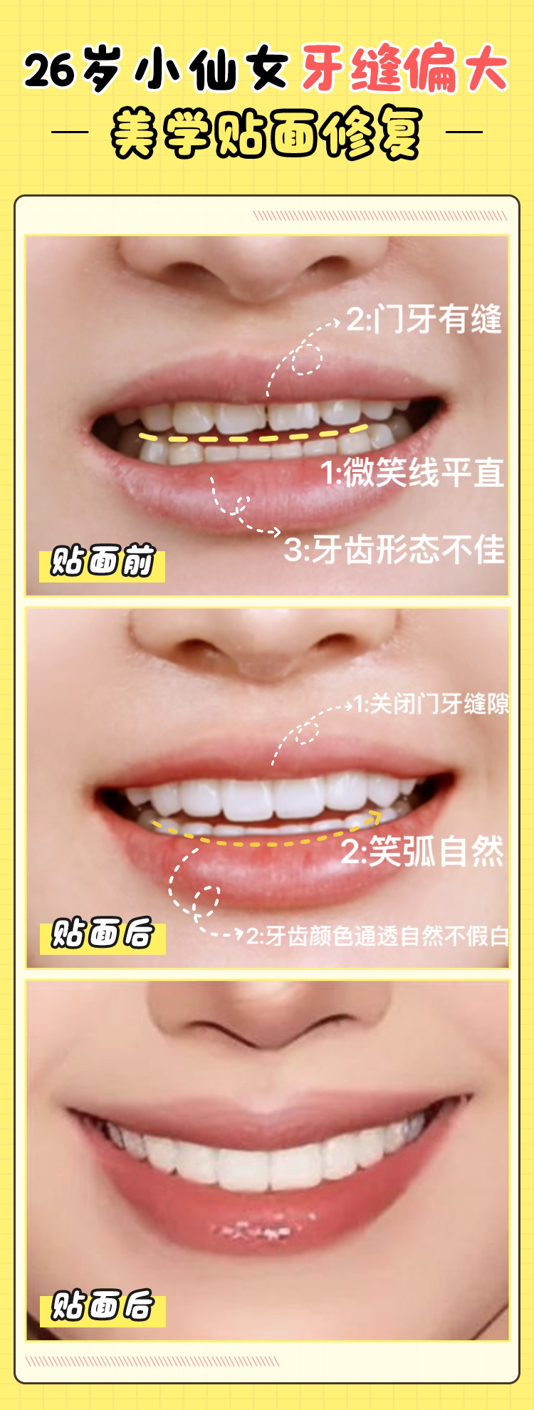 桂林王李辉口腔价格表贵吗？单颗种植3k+/矫正6k+不贵，附全瓷牙贴面收费