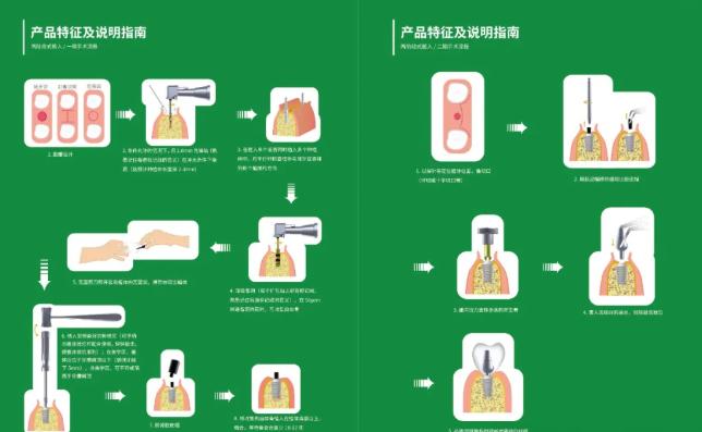 植是道种植体植入过程