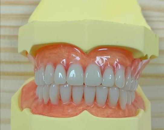 什么是吸附式全口义齿？比传统全口牙固位力强，奶奶戴了能啃玉米超开心