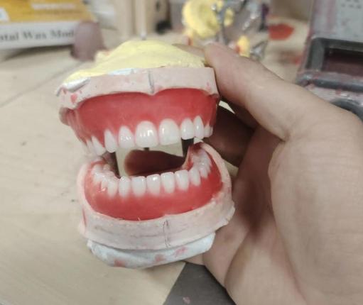 吸附式全口义齿的使用维护