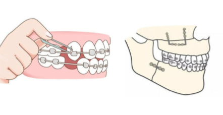常州口腔医院24小时在线问诊矫正牙齿费用