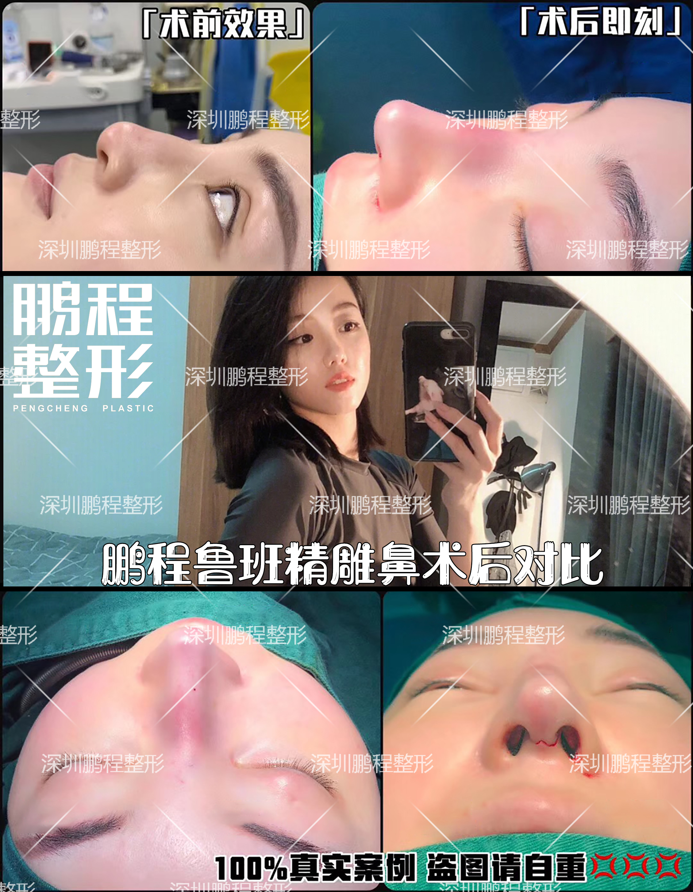 佛山顺德容桂鲁班口腔门诊部