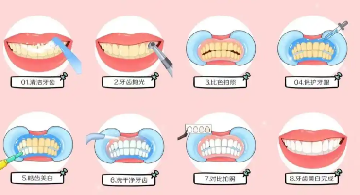 深圳芮凡口腔电话是啥？医生沟通耐心，提供详尽诊断治疗建议！