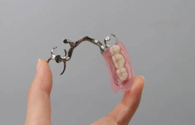 纯钛义齿和吸附性义齿哪个好？牙床条件好选纯钛义齿，全口无牙选吸附性义齿