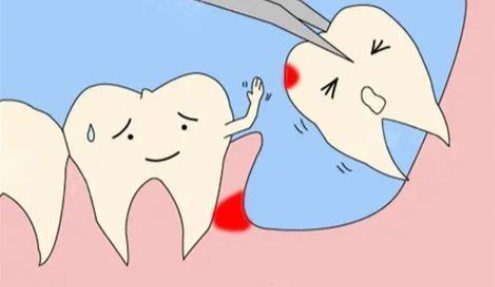 拔牙后三天还疼就一定是干槽症吗？揭秘拔完牙三四天隐隐疼的真相