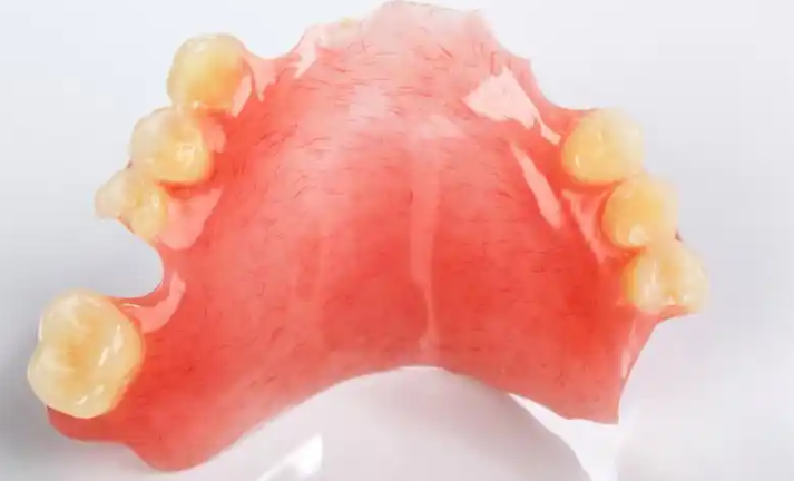 老人镶牙满口哪种材料好？活动假牙、固定假牙、种植牙材料全解析