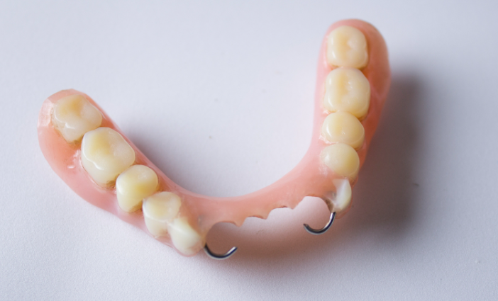 老人镶牙满口哪种材料好？活动假牙、固定假牙、种植牙材料全解析