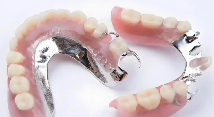 老人镶牙满口哪种材料好？活动假牙、固定假牙、种植牙材料全解析