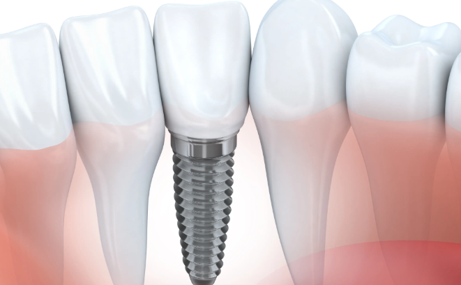 赣州李德贞口腔特色项目