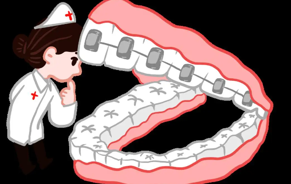 泸州微笑口腔正牙口碑好吗？是！用户亲测地包天矫正疗效明显，江阳店地址好找