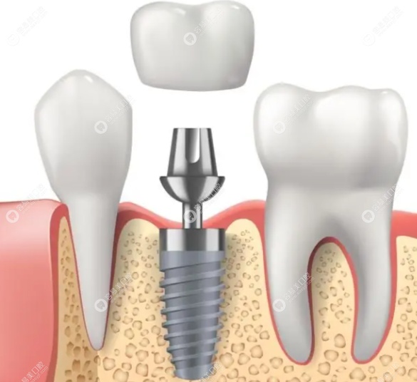 常州中諾口腔醫(yī)院張英漢