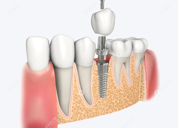 蘇州相城湯米口腔診所楊武