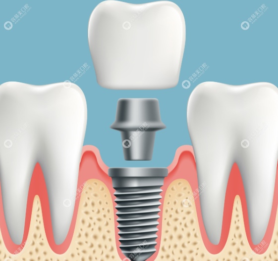 杨武医生怎么样
