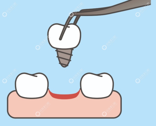 寶雞微笑口腔醫(yī)院周俊青