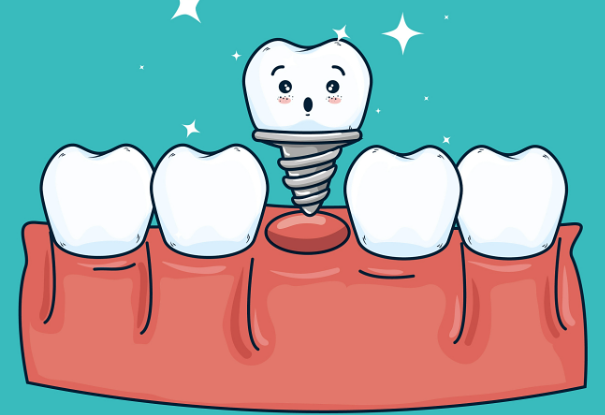 福州牙博士口腔价格曝光：种植牙、正畸、镶牙费用全解析，让你心中有数！