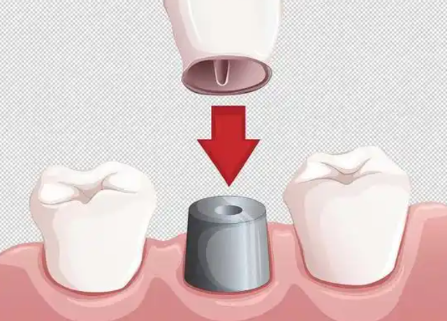 福州牙博士口腔怎么样？技术稳定，项目全，看牙体验反馈不错