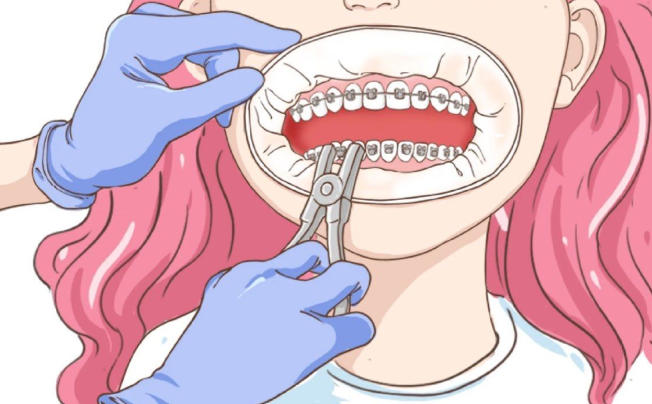 北京禾禾齿科张栋梁正畸价格:透明化收费到底怎么样?