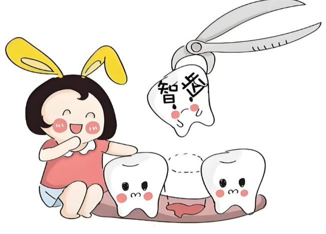 深圳古氏口腔拔牙特色：舒適化智齒拔除新選擇，告別拔牙恐懼