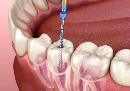鹽城雅潔口腔根管治療不錯(cuò)，提供個(gè)性化方案及優(yōu)質(zhì)服務(wù)室亮點(diǎn)