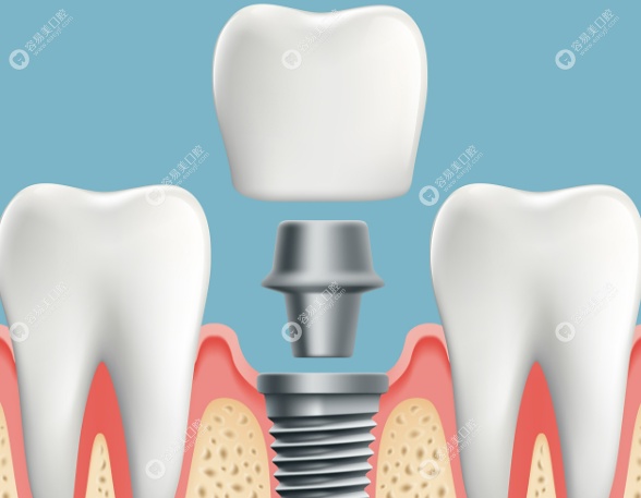 刘清阳医生擅长项目