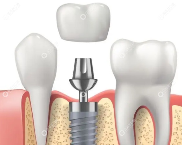 刘清阳医生理念