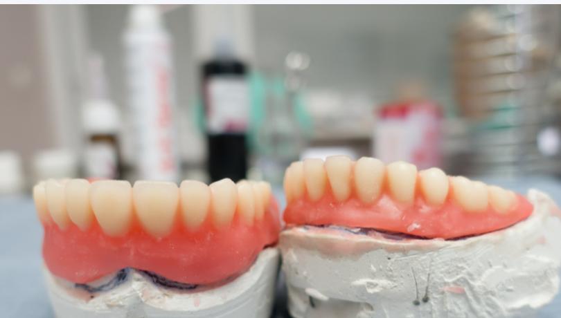 太原皓雅口腔院長(zhǎng)劉建林怎么樣？分享我全口重建的真實(shí)經(jīng)歷，劉院長(zhǎng)親診不僅技術(shù)好且脾氣超耐心