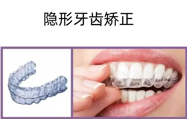 四、患者可能關心的其他問題