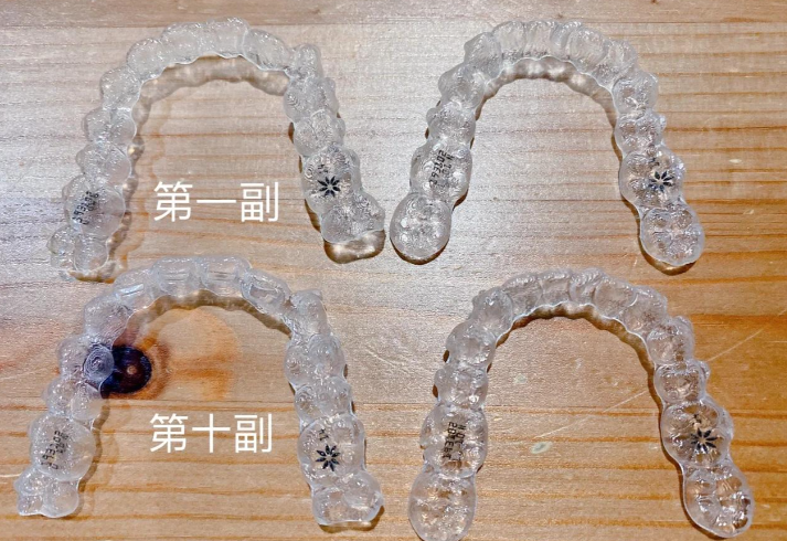 鹽城何永桂口腔醫(yī)生怎么樣？隱形矯正技術(shù)強(qiáng)，價(jià)格透明口碑佳！  